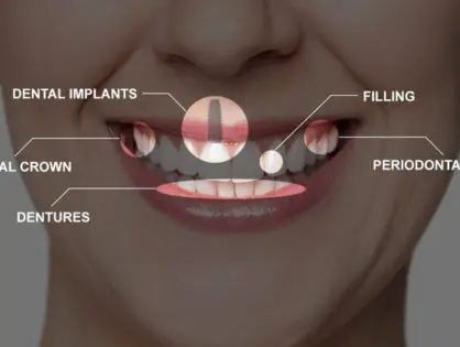 Full mouth rehabilitation and dental restoration at Gupta Dental Hospital Chandigarh
