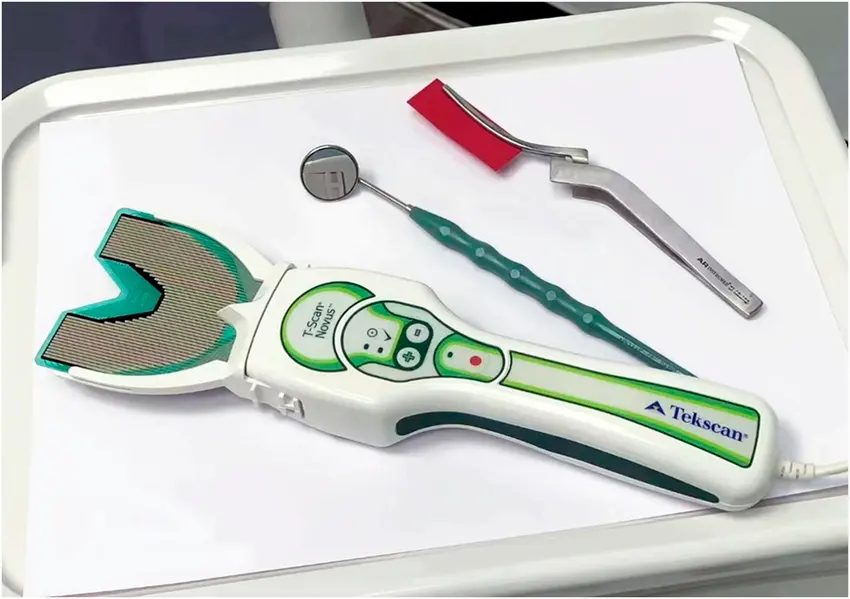 Tekscan digital bite analysis system for precise occlusal diagnosis at Chandigarh dental clinic