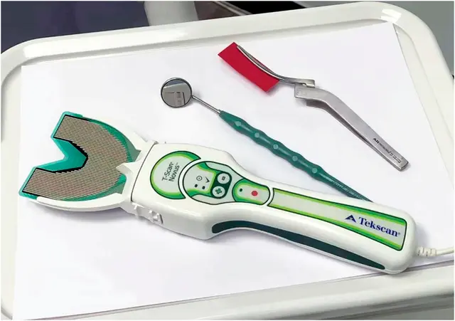 Tekscan digital bite analysis system for precise occlusal diagnosis at Chandigarh dental clinic